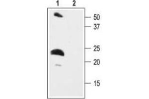 anti-Potassium Voltage-Gated Channel, Isk-Related Family, Member 2 (KCNE2) (AA 88-107), (C-Term), (Intracellular) antibody