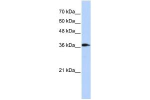 Image no. 1 for anti-ATPase, H+ Transporting, Lysosomal 38kDa, V0 Subunit D2 (ATP6V0D2) (Middle Region) antibody (ABIN2786235)