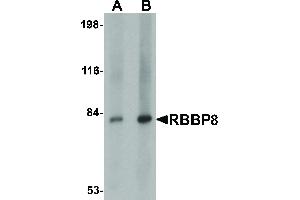 Image no. 1 for anti-Retinoblastoma Binding Protein 8 (RBBP8) (Internal Region) antibody (ABIN6656162)