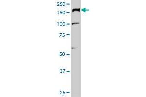 Image no. 3 for anti-Topoisomerase (DNA) II alpha 170kDa (TOP2A) (AA 1435-1531) antibody (ABIN563224)