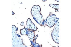 Immunohistochemistry of paraffin-embedded human placenta using MUC1 Rabbit pAb (ABIN6131522, ABIN6144194, ABIN6144195 and ABIN6213810) at dilution of 1:100 (40x lens).