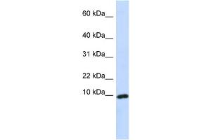 Image no. 1 for anti-gamma-Interferon-Induced Monokine (CXCL9) (Middle Region) antibody (ABIN2792191)