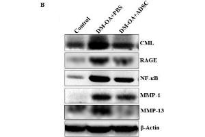 Image no. 8 for anti-Matrix Metallopeptidase 1 (Interstitial Collagenase) (MMP1) (Center) antibody (ABIN2854783)