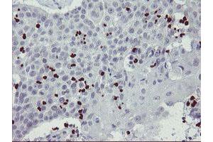 Image no. 4 for anti-Peptidyl Arginine Deiminase, Type IV (PADI4) (AA 299-588) antibody (ABIN1491357)