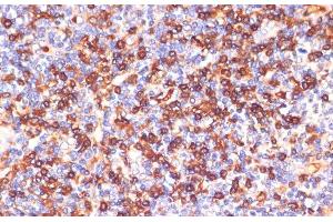 Immunohistochemistry of paraffin-embedded Human tonsil using GPSM2 Polyclonal Antibody at dilution of 1:100 (40x lens).