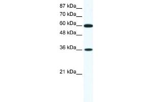 Image no. 1 for anti-Forkhead Box F1 (FOXF1) (N-Term) antibody (ABIN2777415)