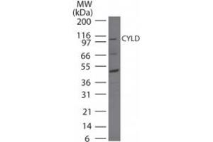 Image no. 1 for anti-Cylindromatosis (Turban Tumor Syndrome) (CYLD) (AA 32-45) antibody (ABIN200017)