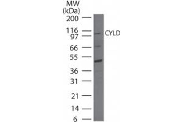 anti-Cylindromatosis (Turban Tumor Syndrome) (CYLD) (AA 32-45) antibody