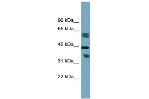 Image no. 1 for anti-Dehydrogenase/reductase (SDR Family) Member 7B (DHRS7B) (Middle Region) antibody (ABIN2782856)