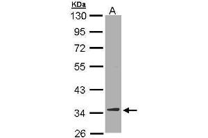 Image no. 4 for anti-2,4-Dienoyl CoA Reductase 1, Mitochondrial (DECR1) (full length) antibody (ABIN2856693)