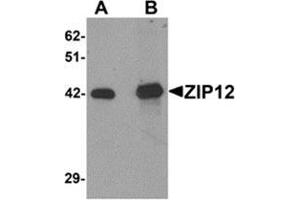 Image no. 1 for anti-Solute Carrier Family 39 (Zinc Transporter), Member 12 (SLC39A12) (N-Term) antibody (ABIN783813)