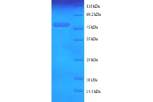 Keratin 5 (KRT5) (AA 2-198) protein (GST tag)