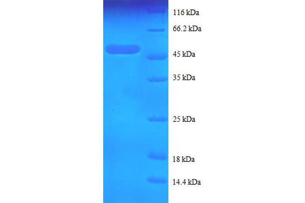 Keratin 5 (KRT5) (AA 2-198) protein (GST tag)
