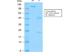 Image no. 5 for anti-Sialophorin (SPN) antibody (ABIN6940632)