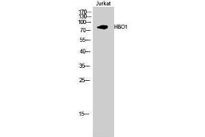 Image no. 1 for anti-MYST Histone Acetyltransferase 2 (MYST2) (Internal Region) antibody (ABIN3184974)