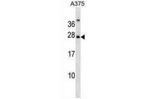 Image no. 1 for anti-RPA Interacting Protein (RPAIN) (AA 15-44), (N-Term) antibody (ABIN954580)