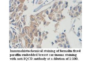 Image no. 1 for anti-IQ Motif Containing D (IQCD) antibody (ABIN6584174)