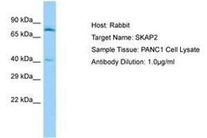 Image no. 1 for anti-Src Kinase Associated Phosphoprotein 2 (SKAP2) (AA 135-184) antibody (ABIN6750138)