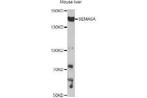 Image no. 1 for anti-Sema Domain, Seven thrombospondin Repeats (Type 1 and Type 1-Like), Transmembrane Domain (TM) and Short Cytoplasmic Domain, (Semaphorin) 5A (SEMA5A) antibody (ABIN6568486)