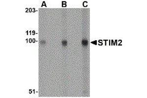 Image no. 1 for anti-Stromal Interaction Molecule 2 (Stim2) (Center) antibody (ABIN2476610)