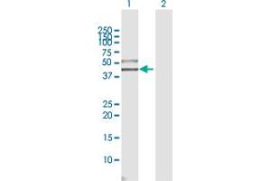 Image no. 2 for anti-Single Immunoglobulin and Toll-Interleukin 1 Receptor (TIR) Domain (SIGIRR) (AA 1-410) antibody (ABIN528391)