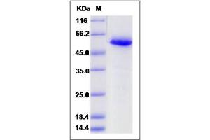 Image no. 1 for Calreticulin (CALR) (AA 1-413) protein (His tag) (ABIN2005779)