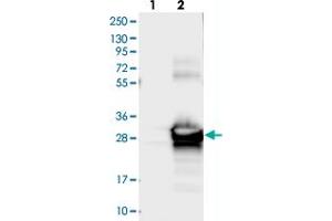 Image no. 2 for anti-Suppressor of IKBKE 1 (SIKE1) antibody (ABIN5587133)