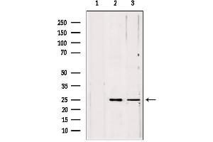 Image no. 2 for anti-Pallidin Homolog (PLDN) (C-Term) antibody (ABIN6264299)