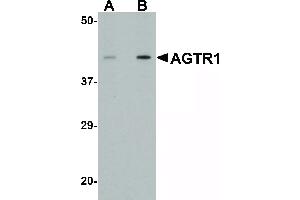 anti-Angiotensin II Receptor, Type 1 (AGTR1) (Internal Region) antibody