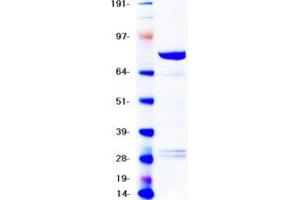 Image no. 2 for B-Raf proto-oncogene, serine/threonine kinase (BRAF) (Active) protein (Myc-DYKDDDDK Tag) (ABIN2715104)