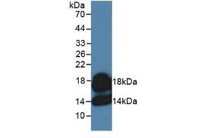 Image no. 5 for Chemokine (C-C Motif) Ligand 7 (CCL7) ELISA Kit (ABIN6574138)