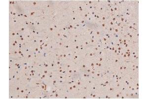Image no. 7 for anti-Signal Transducer and Activator of Transcription 3 (Acute-Phase Response Factor) (STAT3) (pSer727) antibody (ABIN6256411)