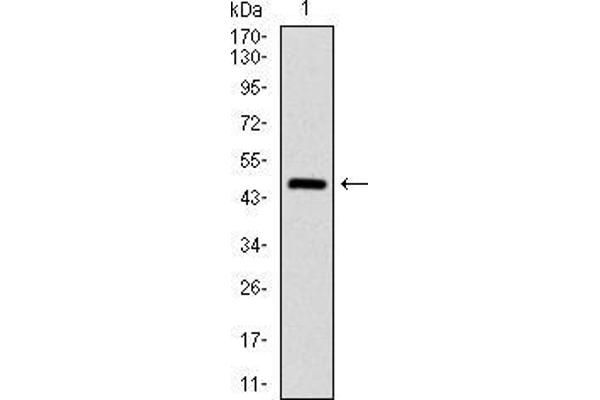 anti-Argininosuccinate Synthase 1 (ASS1) antibody