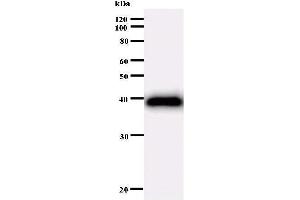 Image no. 2 for anti-AT Rich Interactive Domain 1A (SWI-Like) (ARID1A) antibody (ABIN930973)