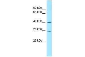 Image no. 1 for anti-DnaJ (Hsp40) Homolog, Subfamily C, Member 11 (DNAJC11) (C-Term) antibody (ABIN2789171)