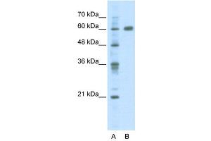 Image no. 2 for anti-PDZ and LIM Domain 5 (PDLIM5) (C-Term) antibody (ABIN2780776)