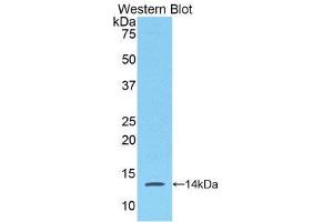 Image no. 1 for anti-Serum Amyloid A (SAA) (AA 20-122) antibody (ABIN1860493)