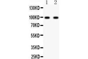 Image no. 3 for anti-Glutamate Receptor, Ionotropic, AMPA 2 (GRIA2) (AA 25-360) antibody (ABIN3043838)