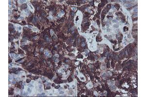Image no. 2 for anti-alpha-2-HS-Glycoprotein (AHSG) antibody (ABIN1496502)
