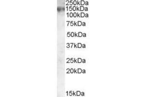 Image no. 1 for anti-ATP-Binding Cassette, Sub-Family C (CFTR/MRP), Member 1 (ABCC1) (Internal Region) antibody (ABIN335109)
