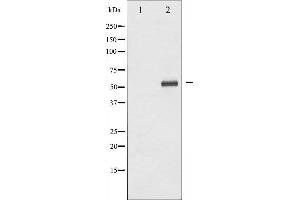 Image no. 1 for anti-Lymphocyte-Specific Protein tyrosine Kinase (LCK) (pTyr393) antibody (ABIN6256726)