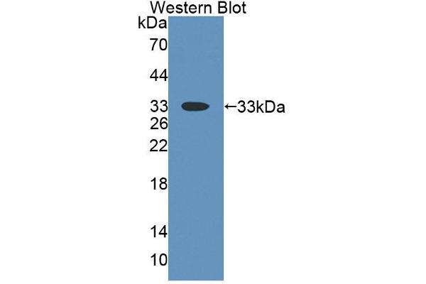anti-Thymocyte Nuclear Protein 1 (THYN1) (AA 1-226) antibody