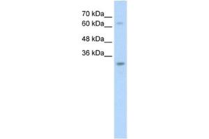 Image no. 1 for anti-Non-SMC Element 1 Homolog (NSMCE1) antibody (ABIN2462690)