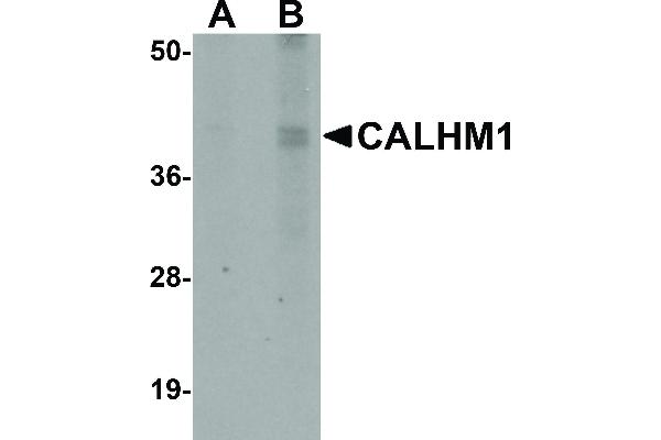 anti-Calcium Homeostasis Modulator 1 (CALHM1) (N-Term) antibody