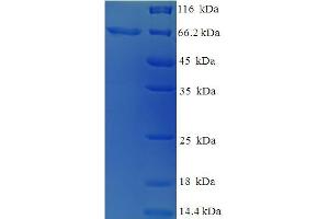Keratin 14 (KRT14) (AA 1-472), (full length) protein (His-SUMO Tag)