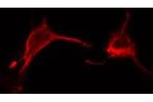Image no. 1 for anti-CD2 (Cytoplasmic Tail) Binding Protein 2 (CD2BP2) antibody (ABIN6260588)