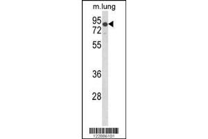Image no. 1 for anti-Low Density Lipoprotein Receptor (LDLR) (Center) antibody (ABIN2489186)