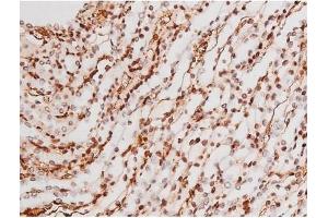 Image no. 3 for anti-Mast/stem Cell Growth Factor Receptor (KIT) (pTyr721) antibody (ABIN6256004)