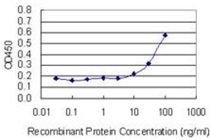 anti-Vacuolar Protein Sorting-Associated Protein 33B (VPS33B) (AA 1-100) antibody