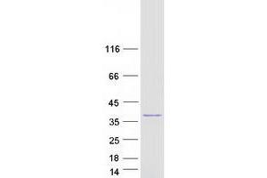 Image no. 1 for Thiosulfate Sulfurtransferase (Rhodanese) (TST) protein (Myc-DYKDDDDK Tag) (ABIN2733584)